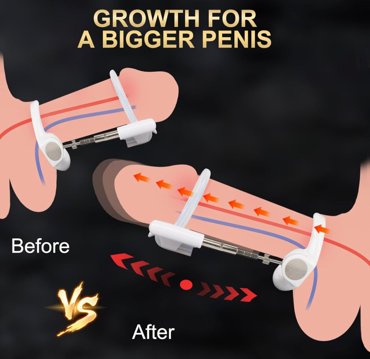 #9 Penis Extender